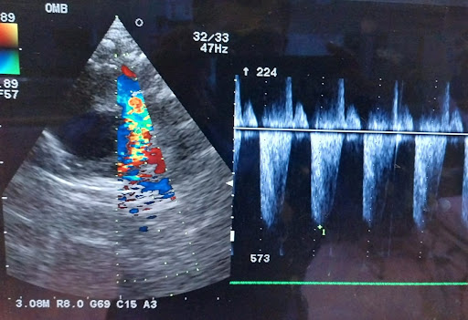 Cardiologo Pediatra -Dr. Alex Catalán